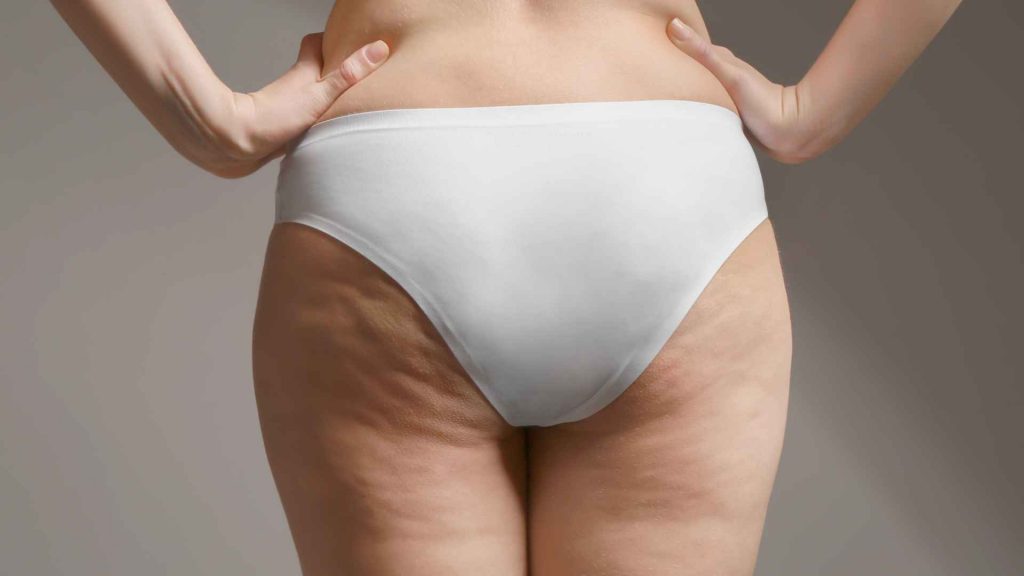 Private Label Cellulite Body Cream