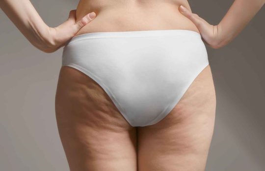 Private Label Cellulite Body Cream2